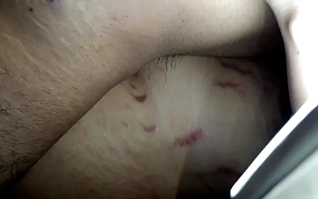 Huge Saggy White Fake Tits Destroyed By Black Skreet Thug